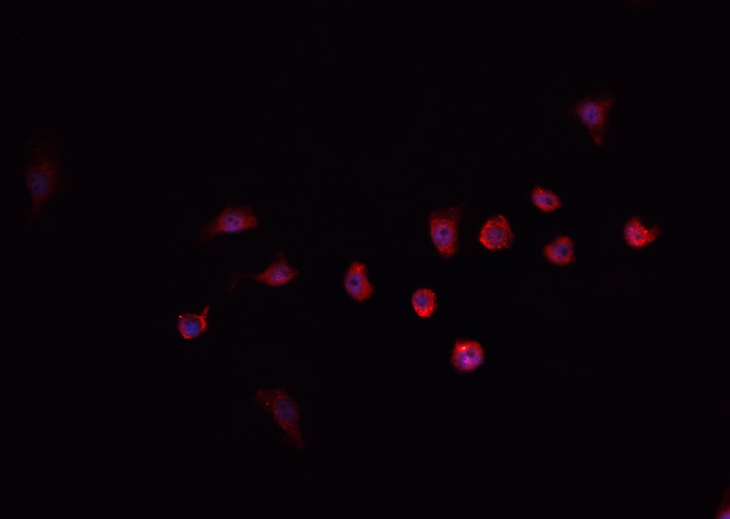 Polyclonal Rabbit anti-Human PRKDC / DNA-PKcs Antibody (IHC, IF, WB)