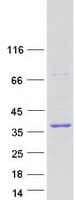 Human GEMIN8 Protein (Recombinant Myc-DDK (Flag))