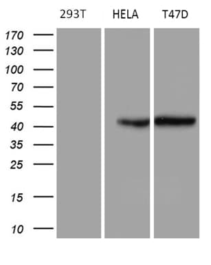 GC / Vitamin D-Binding Protein Antibody (clone OTI2A1, Carrier-free)