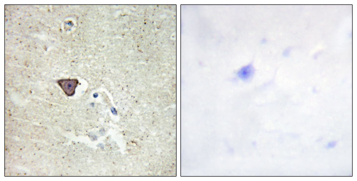 CDH9 / Cadherin 9 Antibody (aa201-250)