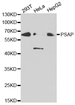 Polyclonal Rabbit anti-Human PSAP / Prosaposin Antibody (IHC, IF, WB)