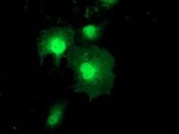 ZFAND2B Antibody (clone OTI1D5)