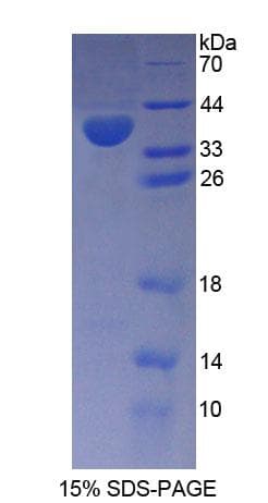 Human PMM1 Protein (Recombinant His-T7)