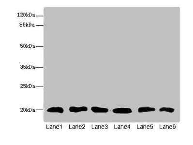 Polyclonal Rabbit anti-Human CFL2 / Cofilin 2 Antibody (IHC, WB)