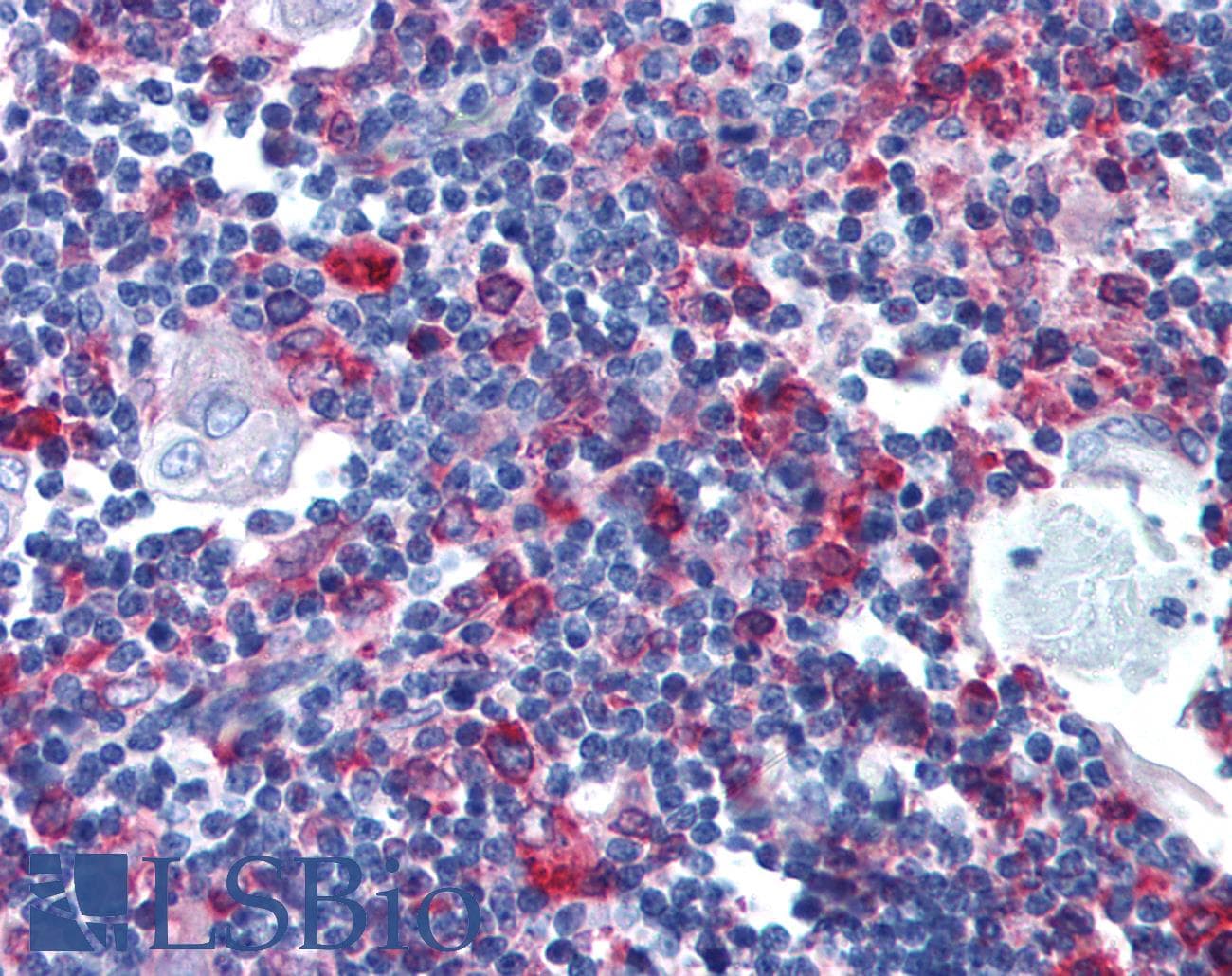PathPlus™ Monoclonal Mouse anti-Human CD74 / CLIP Antibody (clone LN2, IHC)