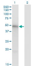 IHC-plus™ MKNK1 / MNK1 Antibody (clone 2H8)
