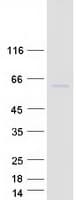 Human CYP4F11 Protein (Recombinant Myc-DDK (Flag))