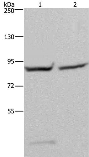 GYS1 / Glycogen Synthase Antibody