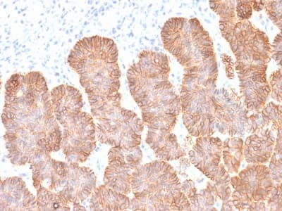 Recombinant Monoclonal Mouse anti-Human EPCAM Antibody (clone rEGP40/1372, aa77-202, IHC, WB)