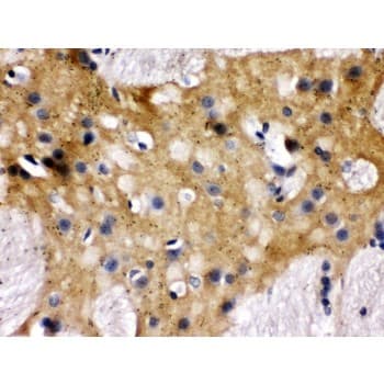 STXBP1 / MUNC18-1 Antibody (aa184-216)