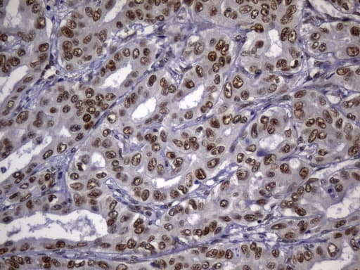 MSH2 Antibody (aa1-304, clone UMAB259)