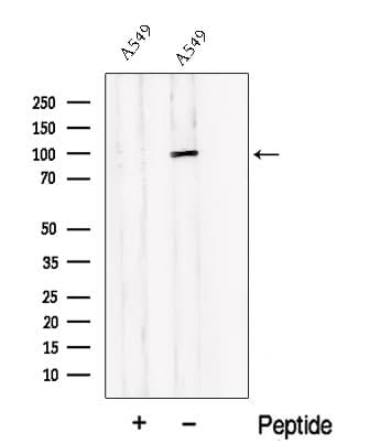 PDE6B / PDE6 Beta Antibody