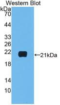 Monoclonal Mouse anti-Human IL-1B / IL-1 Beta Antibody (WB)