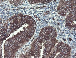 TSC22D1 / TSC22 Antibody (clone OTI3B7)