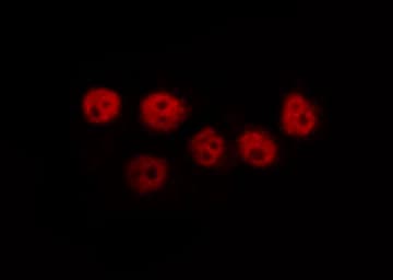 Polyclonal Rabbit anti-Human PPARG / PPAR Gamma Antibody (aa95-124, IHC, IF, WB)