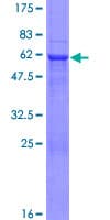 Human NMNAT2 Protein (Recombinant GST)