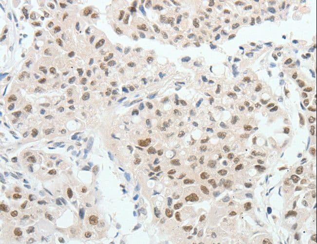 HNF1B / HNF1 Beta Antibody
