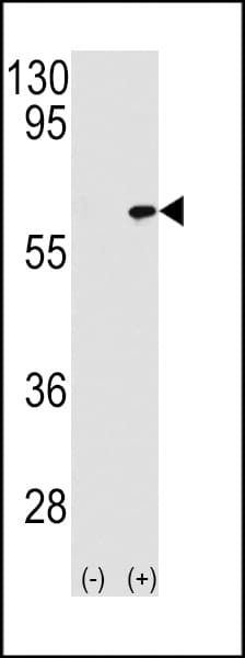 TAB1 Antibody (aa401-430)