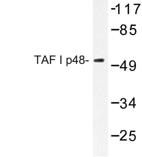 Polyclonal Rabbit anti-Human TAF1A Antibody (Arg318, IHC, WB)