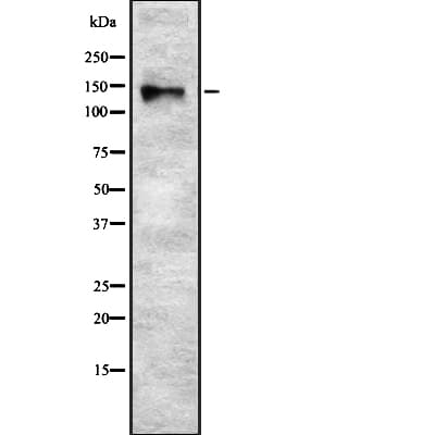 SYNJ2 / Synaptojanin 2 Antibody