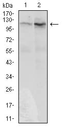 Monoclonal Mouse anti-Human DIS3L2 Antibody (clone 6C7B2, aa27-250, IHC, WB)