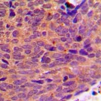 DDX19B Antibody (N-Terminus)