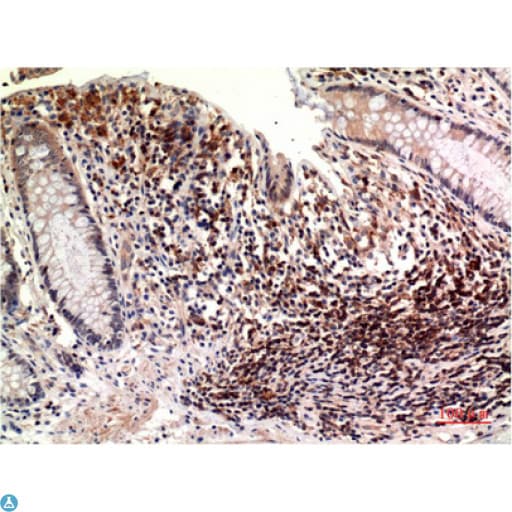 TUBE1 / Tubulin Epsilon Antibody