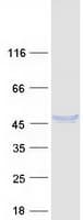 Human DNASE2 / DNase II Protein (Recombinant Myc-DDK (Flag))