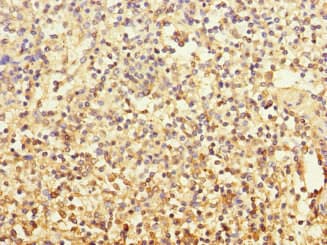 Polyclonal Rabbit anti-Human MCF2L / DBS Antibody (IHC)