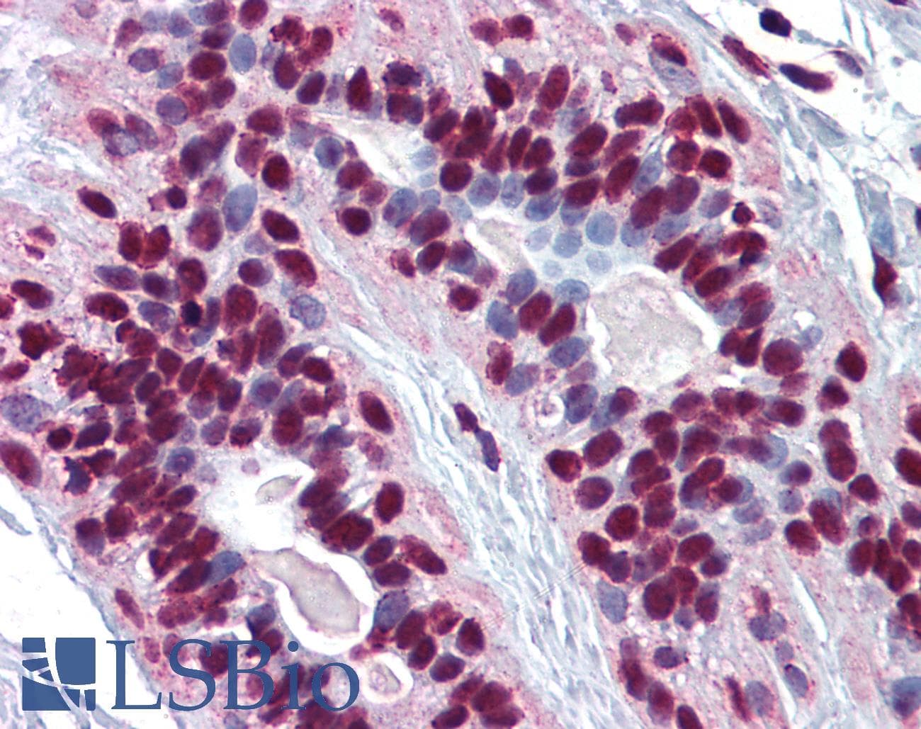 IHC-plus™ CREB1 / CREB Antibody (clone 3F1-1B2)