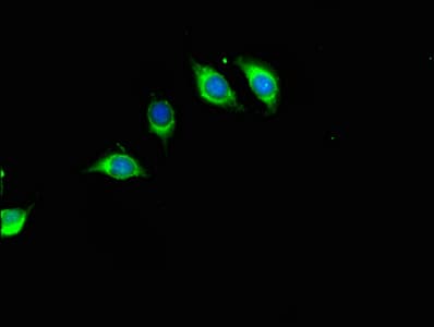 RFK Antibody