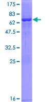 Human SUCLG2 Protein (Recombinant GST)