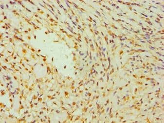 Polyclonal Rabbit anti-Human DAP3 Antibody (aa159-398, IHC, WB)