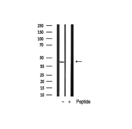Polyclonal Rabbit anti-Human APG4B / ATG4B Antibody (IHC, IF, WB)