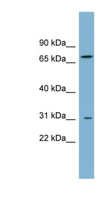 PMP70 Antibody (aa143-192)