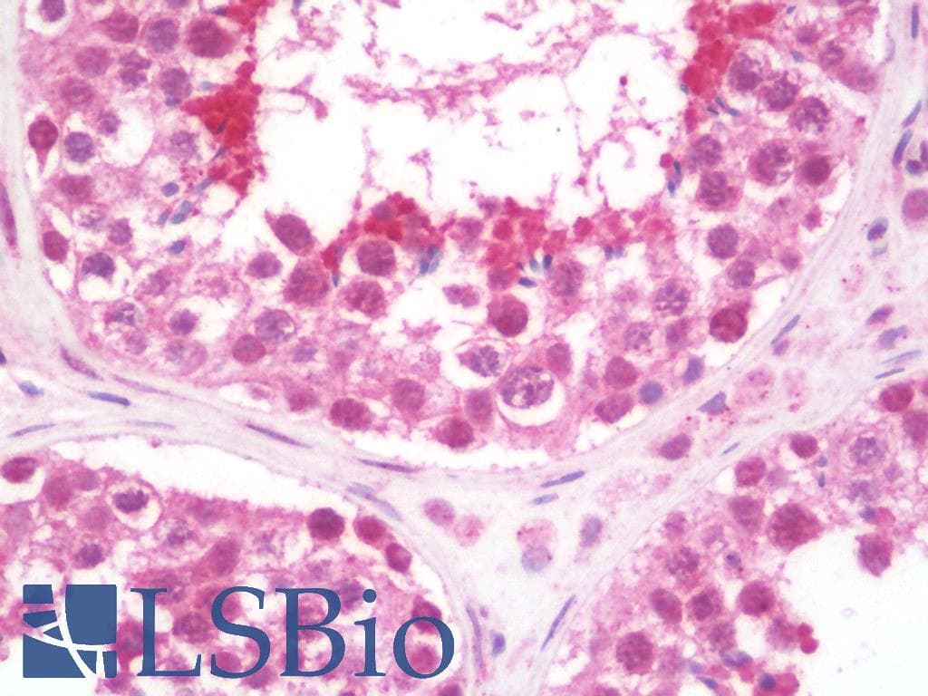 IHC-plus™ Polyclonal Rabbit anti-Human AMIGO Antibody (IHC, IF, WB)