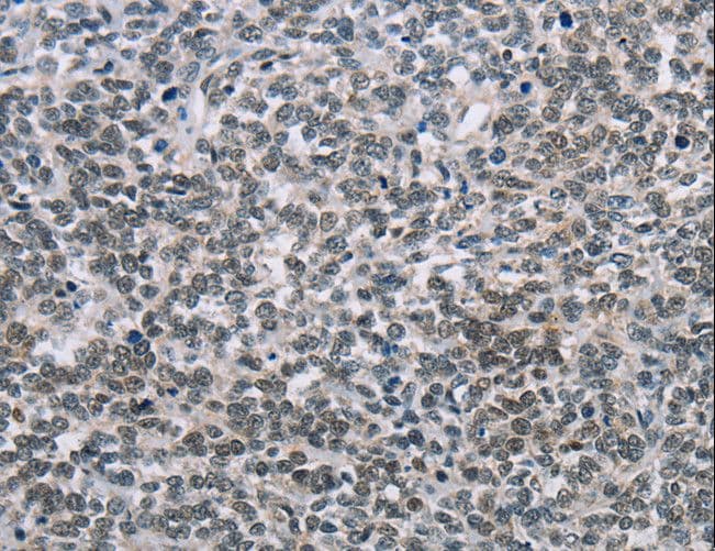 Polyclonal Rabbit anti-Human TONSL Antibody (IHC)