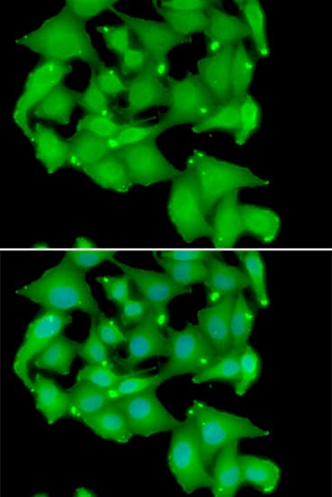 PKD3 / PRKD3 Antibody