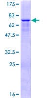 Human ZNF550 Protein (Recombinant GST)