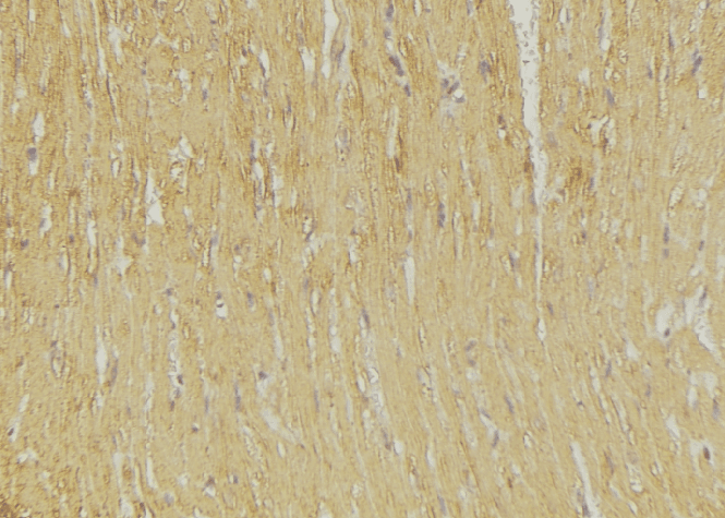 Polyclonal Rabbit anti-Human GRIA2 / GLUR2 Antibody (IHC, WB)
