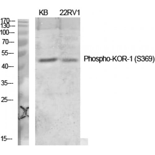 OPRK1 / Kappa Opioid Receptor Antibody (310-390 aa)