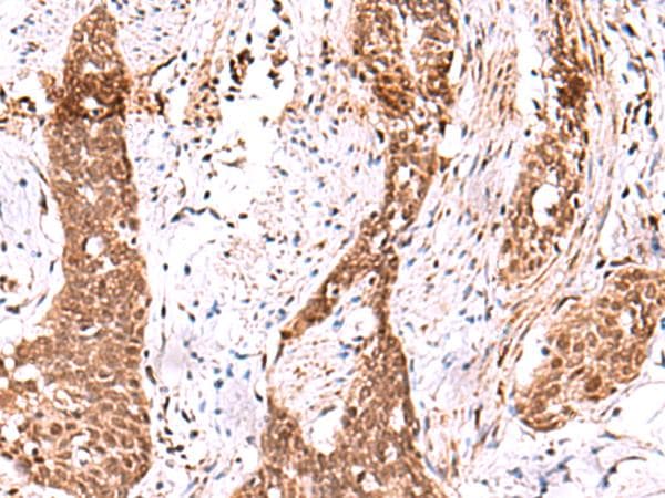 AK9 / AKD1 / AKD2 Antibody
