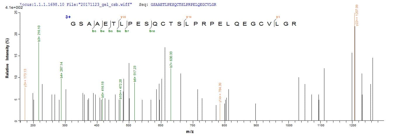 Human ADAMTS18 Protein (Recombinant 6His, N-terminus)