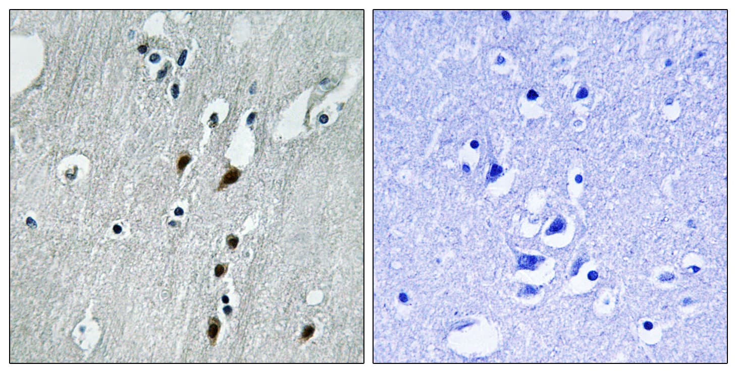 Polyclonal Rabbit anti-Human PDCD4 Antibody (phospho-Ser457, IHC, WB)
