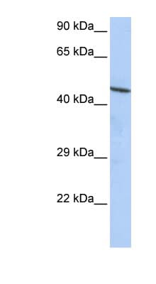Polyclonal Rabbit anti-Human ZNF830 / CCDC16 Antibody (aa72-121, WB)
