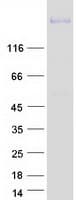 Human PLXNC1 / Plexin C1 Protein (Recombinant Myc-DDK (Flag))