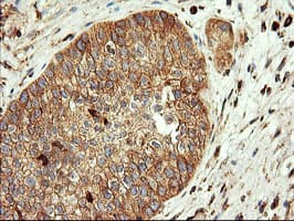 ENPEP / Aminopeptidase A Antibody (clone OTI3G1)