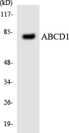 ALDP / ABCD1 Antibody (aa526-575)