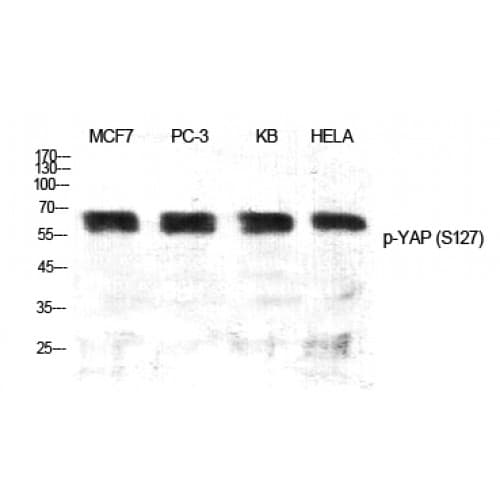 Polyclonal Rabbit anti-Human YAP / YAP1 Antibody (70-150 aa, IHC, WB)