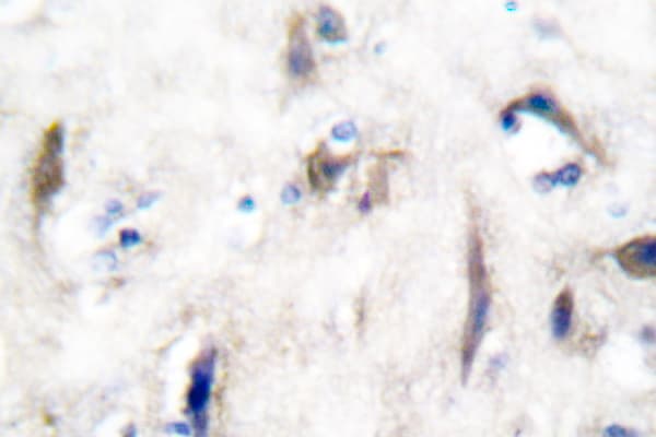 PTPN11 / SHP-2 / NS1 Antibody (Ser350)
